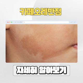 카페오레반점, 밀크커피반점