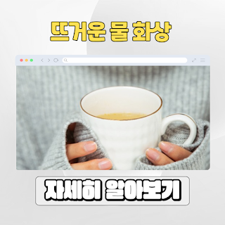 뜨거운물 손데였을때 화상